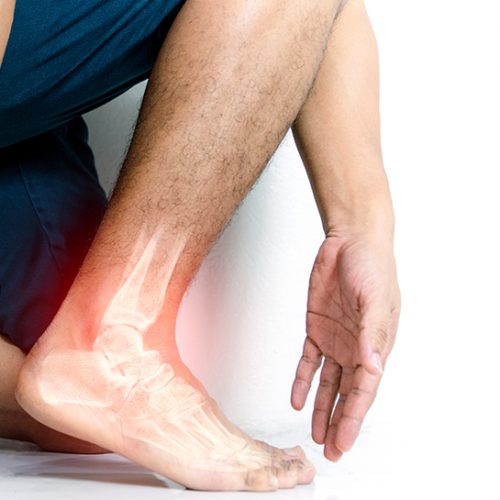 3 Common Foot & Ankle Conditions You Shouldn’t Ignore