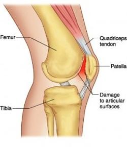 Knee Structure and Injuries
