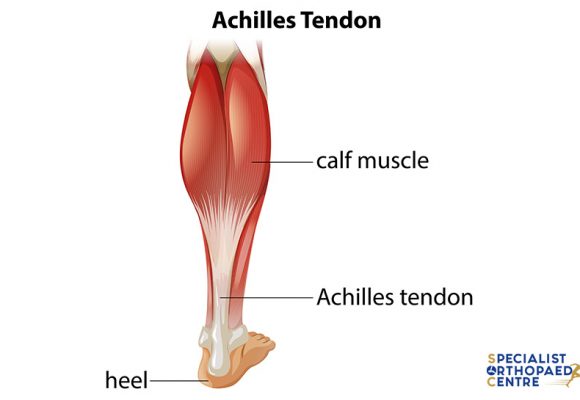Keeping Our Achilles Tendon Healthy