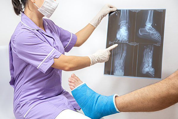orthopaedic doctor showing an xray of broken ankle