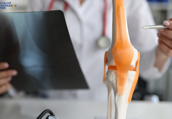 All About The Latest Advancements In Knee Replacement Surgery