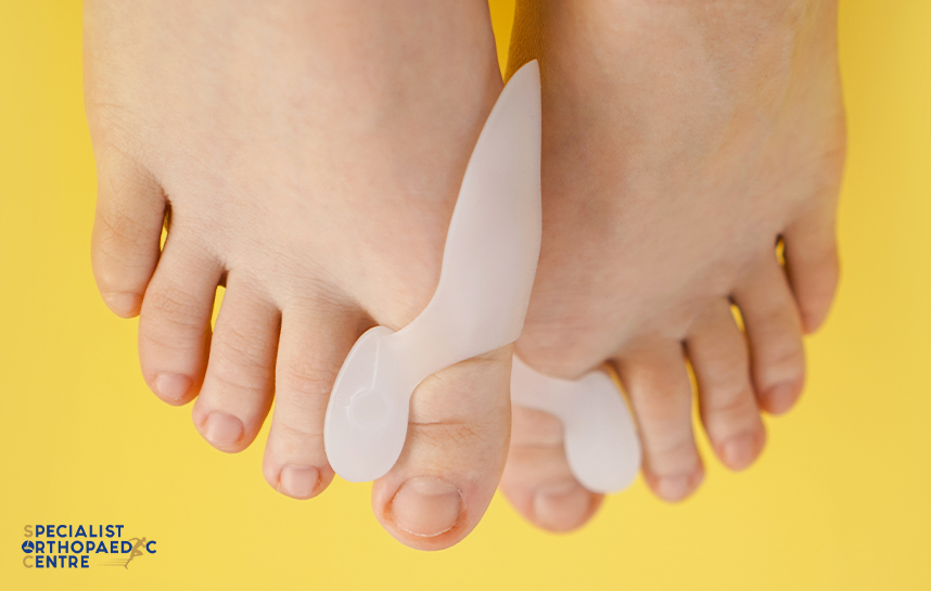 Treatment Options bunion surgery in Singapore