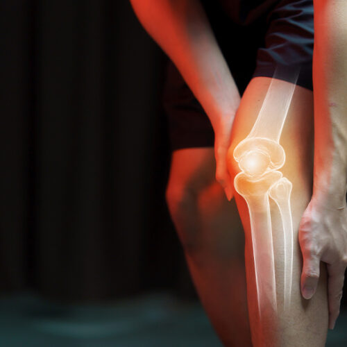 7 Factors That Put You At Risk Of Suffering From A Knee Injury