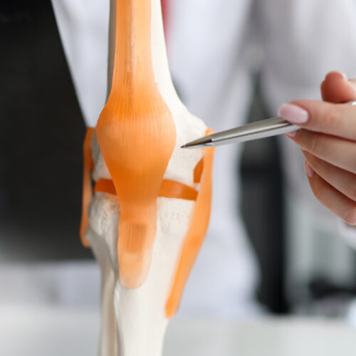 Myths About Total Knee Replacements
