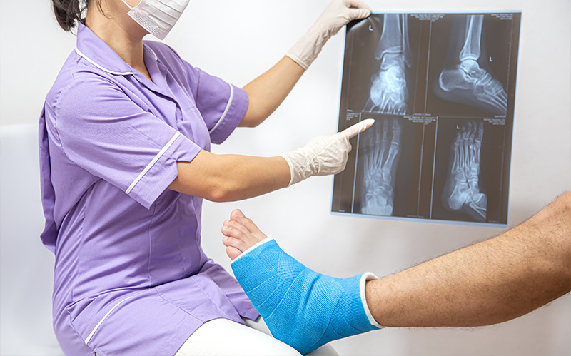 Orthopaedic specialist pointing to a foot X-ray next to a patient in a blue cast.